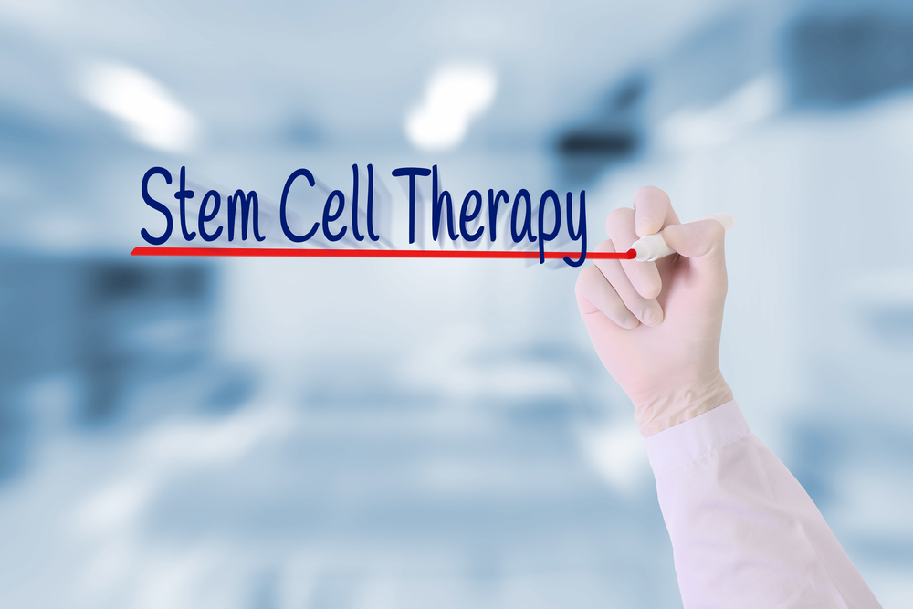 stem cell therapy