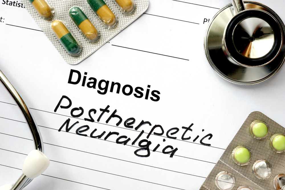 Postherpetic Neuralgia