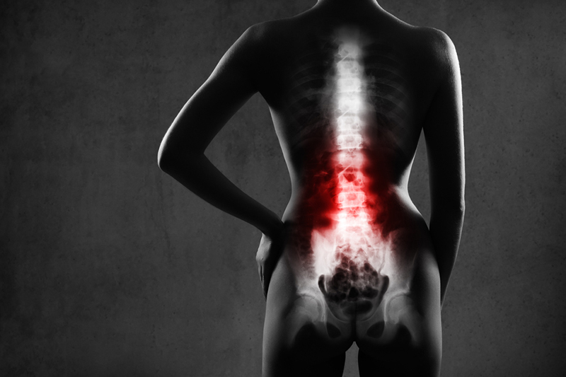 Discogenic Low Back Pain / Degenerative Disc Disease - The Orthopedic Pain  Institute, Beverly Hills Pain Management Specialist