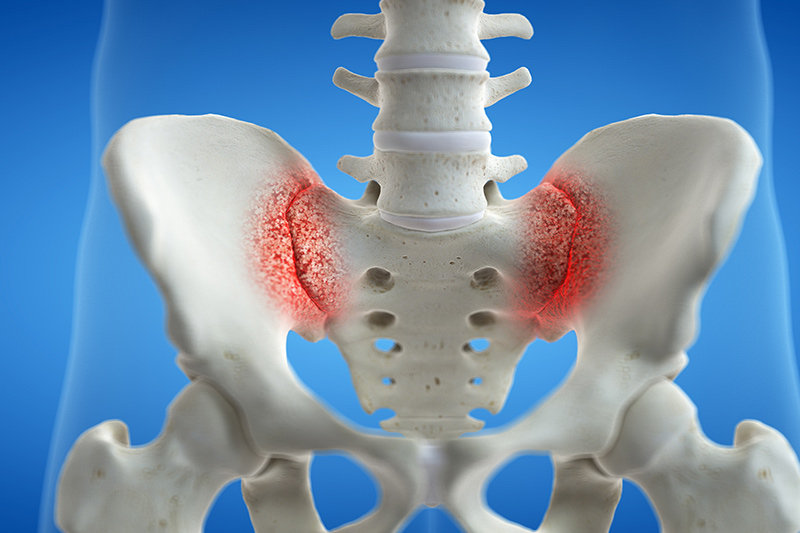 Sacroiliac Joint Pain  Novus Spine & Pain Clinic, Lakeland, Florida