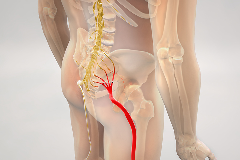 https://www.orthopedicpaininstitute.com/images/dental-services/sciatica.jpg